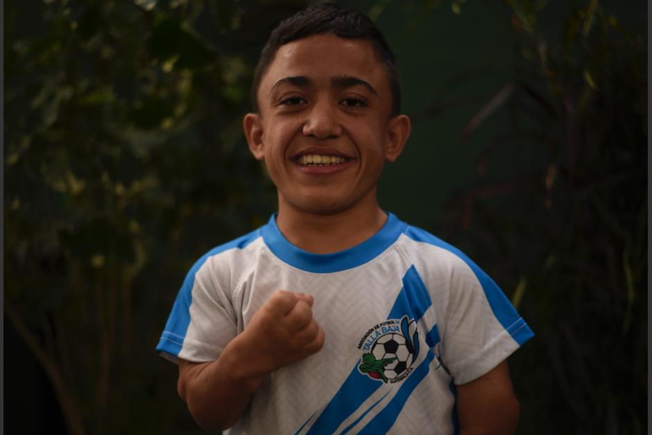 Francis Cordón, conocido como "Chachi", inició su aventura en la Selección de Talla Baja luego de ver un anuncio en el periódico. (Foto: Wilder López/ Soy502)