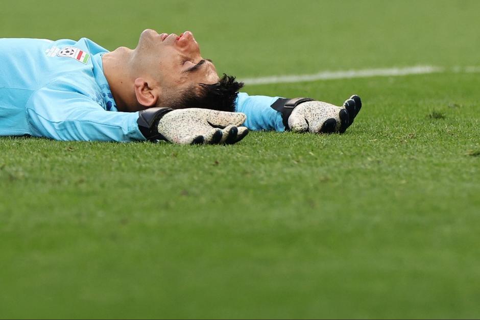 El portero de Irán sufrió un fuerte golpe por lo que tuvo que ser sustituido. (Foto: AFP) 