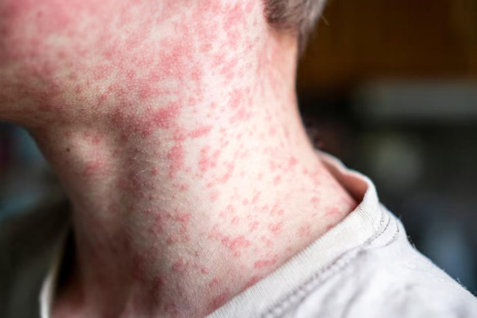 Estos son los casos sonados. (Foto: Pexels)