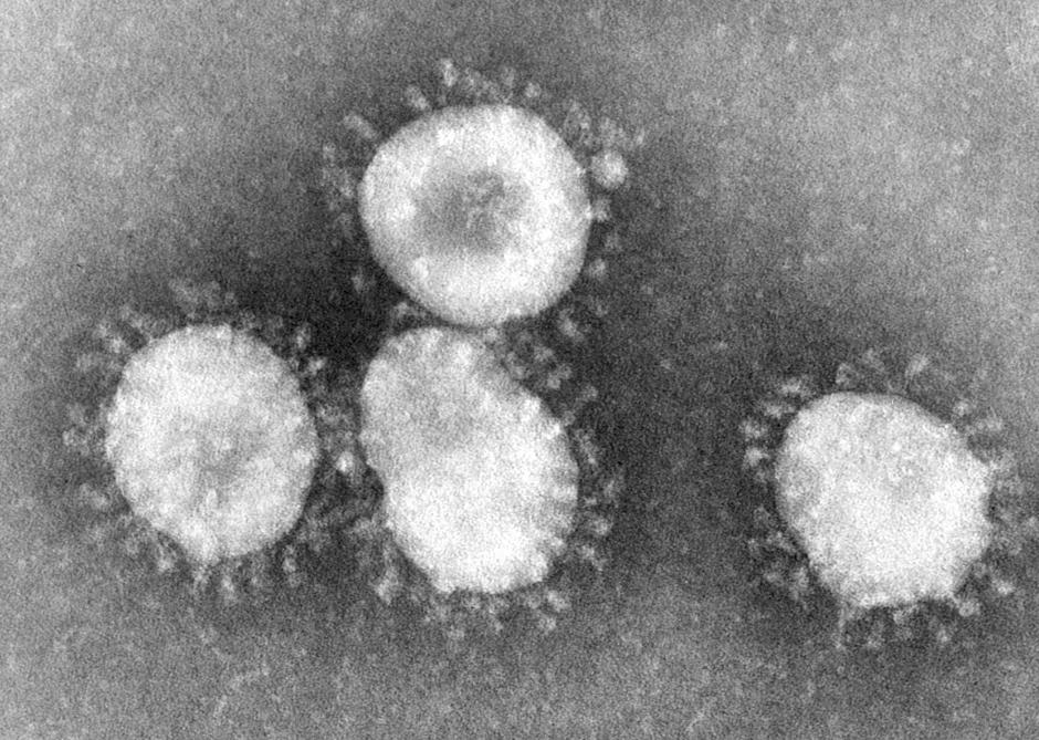 El coronavirus bajo un microscopio. (Foto: EFE/Archivo)