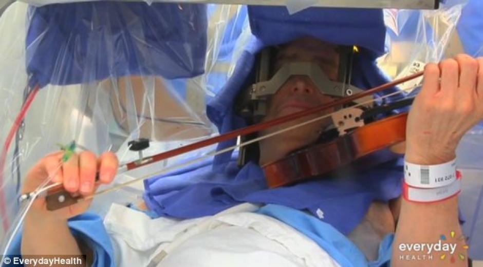 Mientras los médicos le operaban el cerebro para colocarle un electrodo, Robert Frisch tuvo que colaborar tocando su violín para ubicar el lugar exacto que le provocaba temblores en las manos. (Foto: Everyday Health/Daily Mail).