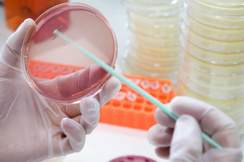 La nueva bacteria es inmune a los antibióticos más potentes que existen en la actualidad. (Foto: El País)