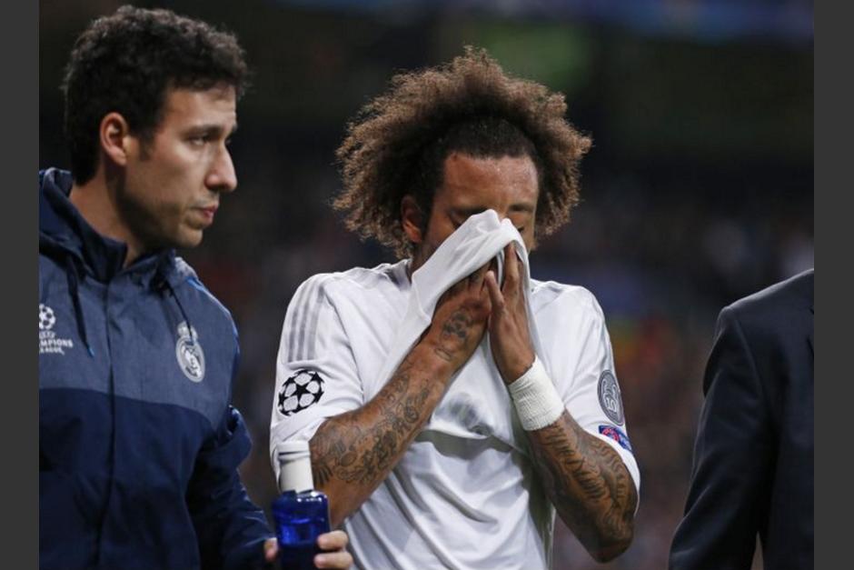 Marcelo se toma el rostro, dolor y preocupación. Se perderá el juego Brasil-Argentina, y tampoco llegaría bien al clásico español el 21 de noviembre. (Foto: Twitter)