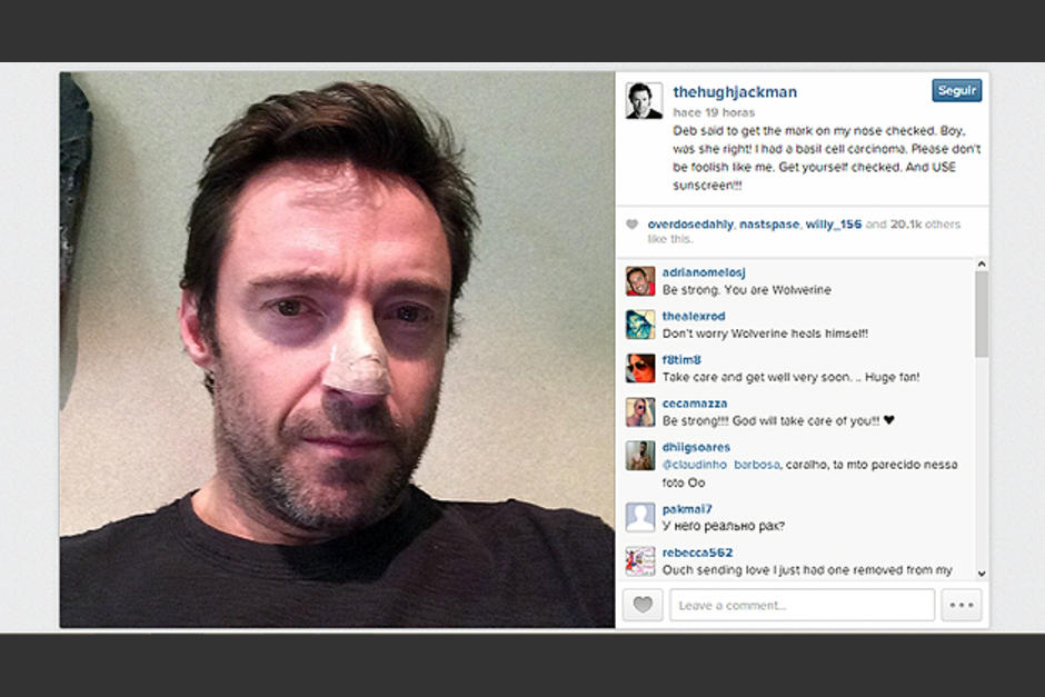 Hugh Jackman compartió su padecimiento de cáncer de piel. (Foto: Instagram)