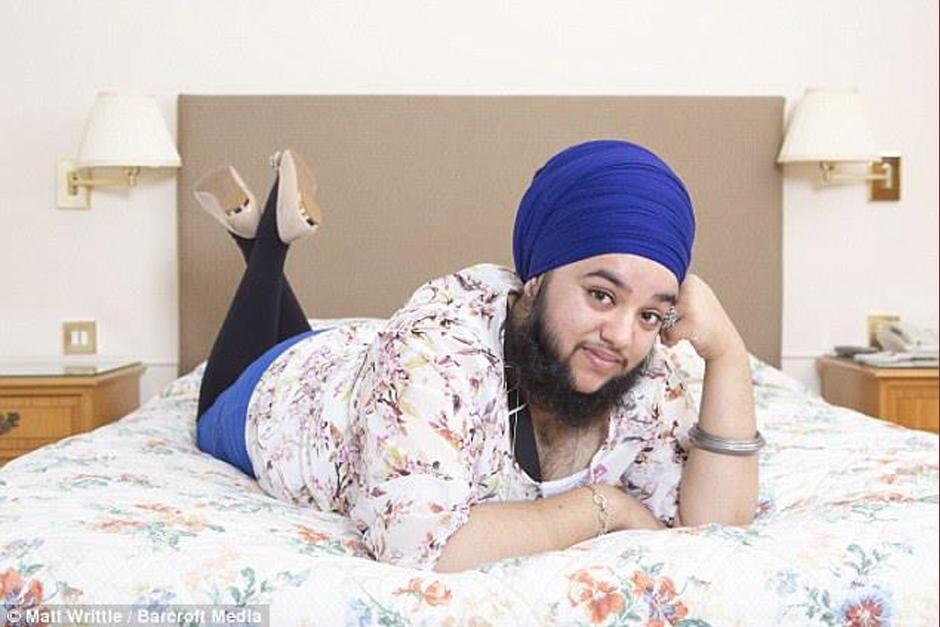 Harnam Kaur es una joven que padece una extraña enfermedad que causa la aparición de vello excesivo en su cuerpo. (Foto: Facebook)