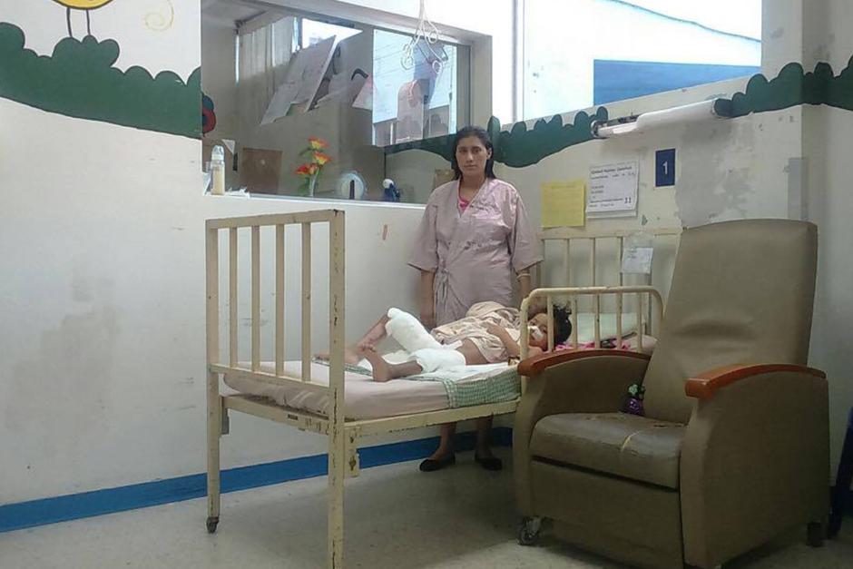 Kimberñy sufrió quemaduras de segundo grado en sus piernas y abdomen. (Foto: Jorge Sente/Nuestro Diario)