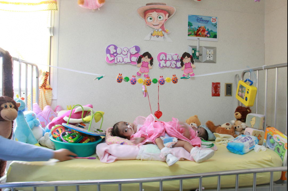 "Las Rositas" han alcanzado el peso mínimo requerido para ser intervenidas quirúrgicamente. Las siamesas serían separadas en un hospital de Estados Unidos. (Foto: Jesús Alfonso/Soy502)