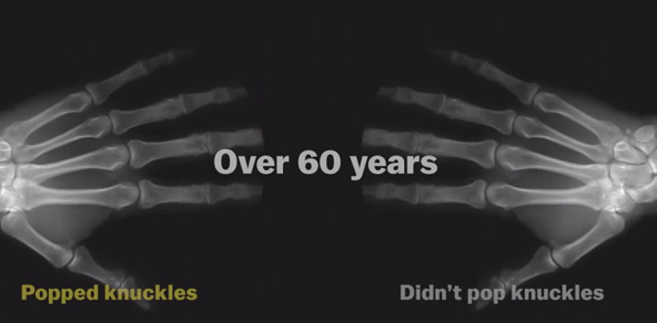 Un hombre hizo un experimento durante 60 años para demostrar que “tronarse“ los dedos puede ser molesto, pero no dañino para tu salud. (Foto: Vox.com)
