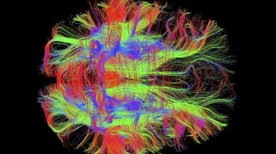 En esta imagen obtenida con la técnica de resonancia magnética se aprecian las fibras nerviosas en el cerebro de un adulto saludable. Su autor es Zaynep M. Saygin, del Instituto de Tecnología de Massachusetts, Estados Unidos