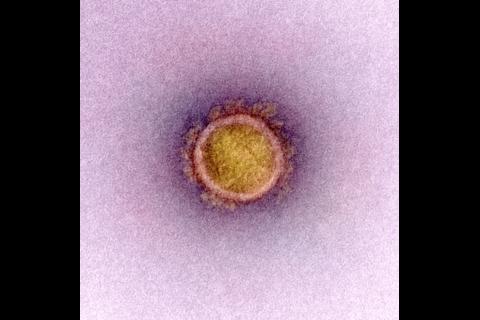 Fotos: Muestran proceso de ataque al cuerpo del Covid-19