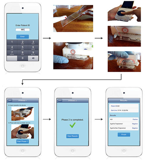 Pasos del test de VIH y s&iacute;filis con el accesorio para smartphones. (Foto: Tassaneewan Laksanasopin)