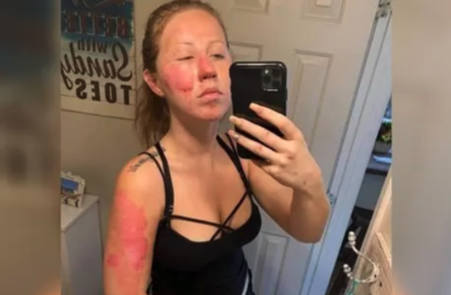 As&iacute; qued&oacute; el rostro de la joven. (Foto: Instagram)