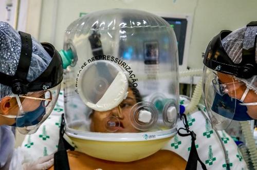 Esta mujer brasileña usa un sistema de respiración no invasivo para evitar la intubación. (Foto: AFP)