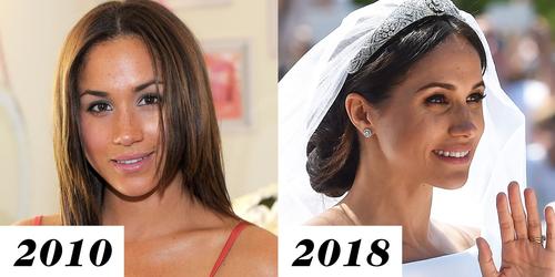 El antes y el después de Meghan Markle. (Foto: Marie Claire)