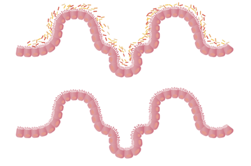 La flora intestinal puede verse afectada por el uso periódico de antibióticos. (Gráfica: Pixabay)