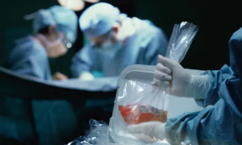 Momento en que un paciente es intervenido para recibir un órgano. (Foto: The Guardian)