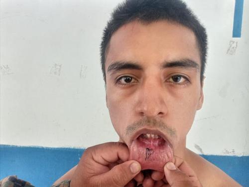 El marero tenía escondido en su boca un tatuaje. (Foto: Nayib Bukele)