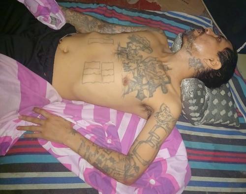 El marero fue encontrado postrado a una cama sin poder moverse tras las m&uacute;ltiples fracturas que tiene. (Foto: Polic&iacute;a de el Salvador)