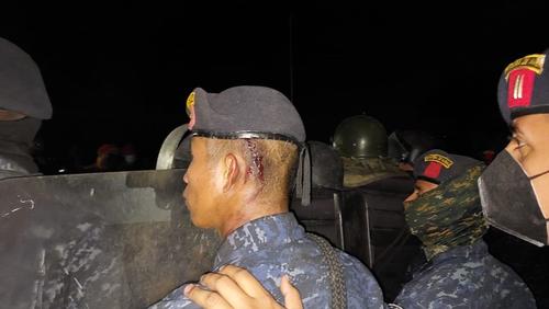 Uno de los militares que resultó lesionado. (Foto: PNC) 
