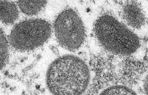 Así luce el virus de la viruela del mono. (Foto: CNN)