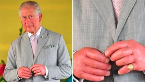 El rey Carlos III ya se ha dejado ver con las manos "hinchadas" en varias ocasiones. (Foto: Infobae)