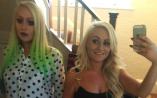 Dolly y Daisy Simpson antes de las operaciones. 