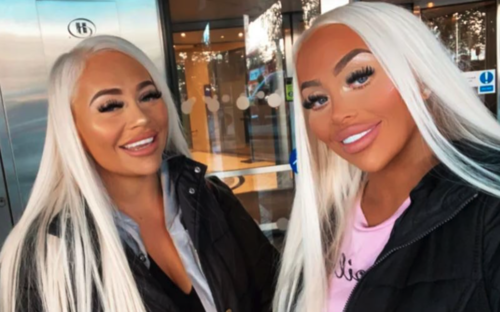 Dolly y Daisy Simpson después de las operaciones.