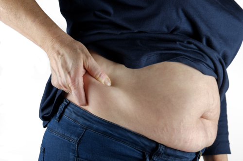 El exceso de peso corporal puede provocar diversas dolencias, entre ellas, enfermedad crónica renal. (Foto: Pixabay)