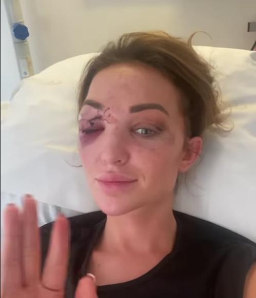 Chayenne van Aarle sufri&oacute; fuertes golpes. (Foto: captura de video)
