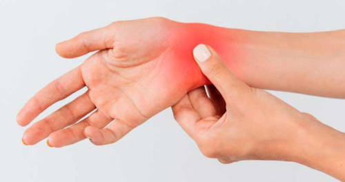 El síndrome del túnel carpiano puede afectar las manos. (Foto: Medical express)