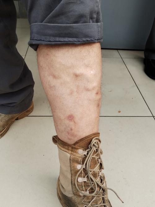 Roosevelt, agresi&oacute;n, motorista, tr&aacute;ficoGT