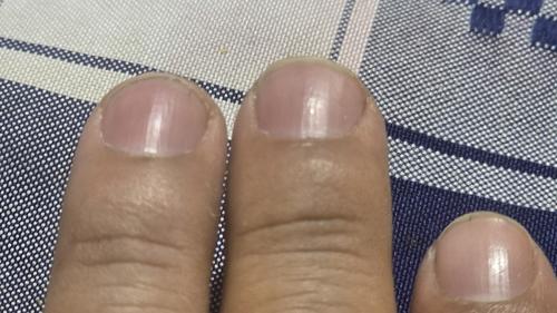 Hidrata tus manos para no padecer de este problema. (Foto: Erick Colop/Colaborador)