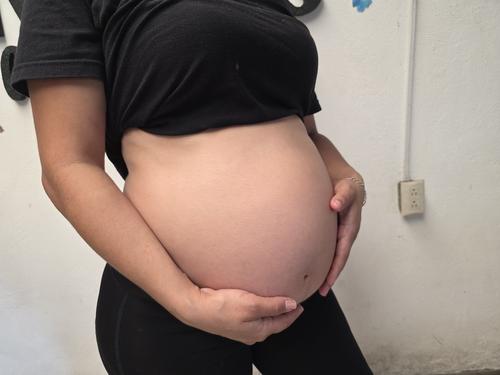 Se debe estar atenta a señales de alarma para evitar inconvenientes tanto para la madre como para el bebé. (Foto: Surama Rodas/Colaboradora)