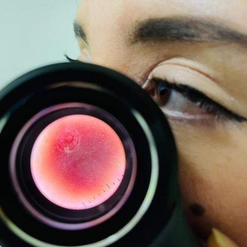 La evaluación de las lesiones de la piel se hacen con equipo especial. (Foto: Erick Colop/Colaborador)