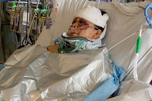 Hilda Lorena Cifuentes sufri&oacute; graves heridas en distintas partes del cuerpo. (Foto: GoFundMe)