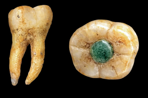 dentadura maya