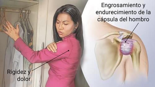 La mayor&iacute;a de los casos se dan en las mujeres. (Foto: Archivo)