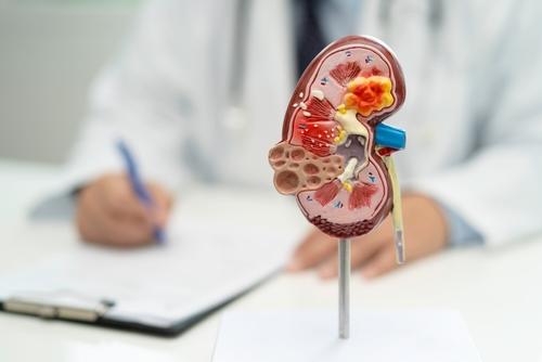 La lista de espera suma cerca de 400 pacientes interesados que deben completar estudios de compatibilidad y evaluaci&oacute;n. (Foto ilustrativa: Shutterstock)