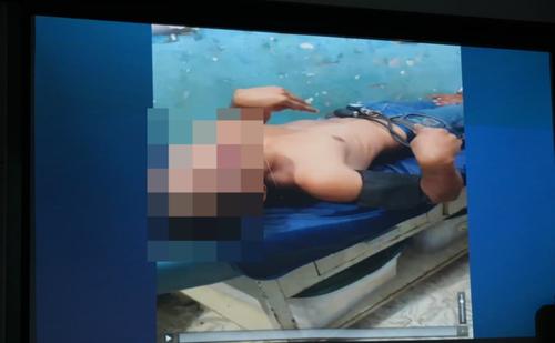 Uno de los j&oacute;venes heridos hasta el momento se encuentra hospitalizado. (Foto: Wilder L&oacute;pez/Soy502)