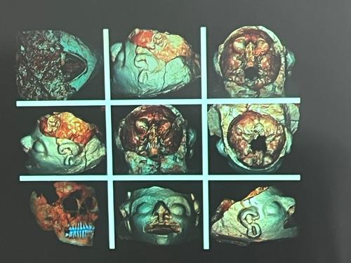 Rostro, estuco, maya, craneo, fundacion, ruta maya, mexicon, investigaci&oacute;n, guatemala, soy502, noticias 3