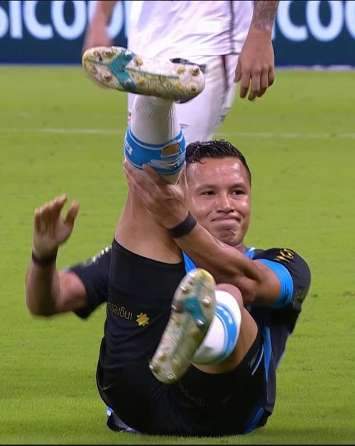 Marlon habr&iacute;a sufrido fractura de tibia y peron&eacute;. (Foto: Redes sociales)