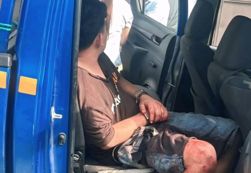 El hombre result&oacute; con heridas tras el intercambio de balas. (Foto: &Eacute;lfego Escobar/Colaborador)