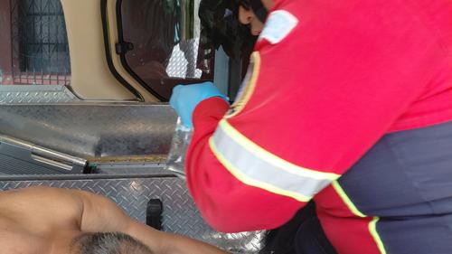 Los adultos mayores presentaban quemaduras de primer, segundo y tercer grado en distintas partes del cuerpo. (Foto: CMB)