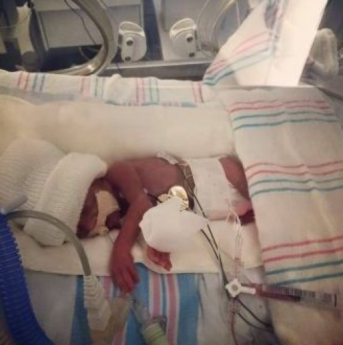 La peque&ntilde;a Ellie, en la sala de cuidados intensivos. (Foto: Houston Chronicle).