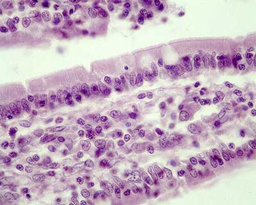 El an&aacute;lisis se llev&oacute; a cabo en c&eacute;lulas epiteliales intestinales IEC-6 de ratas. (Foto Universidad de Los Andes)