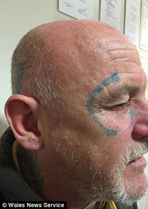 Seguramente este hombre nunca olvidar&aacute; la noche de fiesta en la cual result&oacute; tatuado. (Foto: dailymail.co.uk)