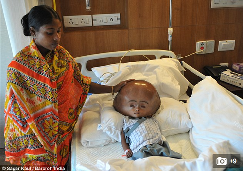 Su condici&oacute;n antes de la operaci&oacute;n era cr&iacute;tica. (Foto: Sagar Kaul/ Barcroft India)