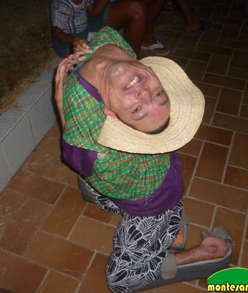 En lugar de zapatos, se ha adaptado una especie de protectores para poder dar algunos pasos recostado no en sus pies, sino sus tibia y peron&eacute;. (Foto: Facebook) 