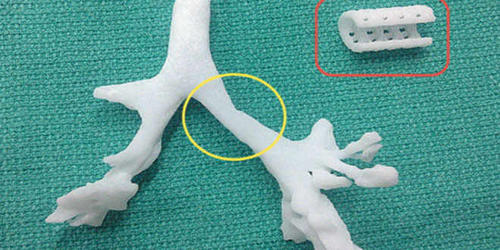 La reproducci&oacute;n en 3D se hizo con un material llamado policaprolactona, bioabsorbible por el cuerpo humano en tres a&ntilde;os. (Foto Medicina Preventiva Santa Fe)