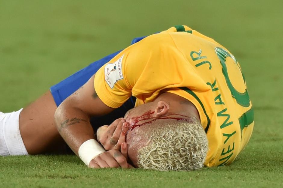 Ney tuvo que dejar el partido al 69'. (Foto: AFP)